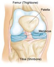 Re-Energise Physio:&#160; Focus on Meniscal Tears